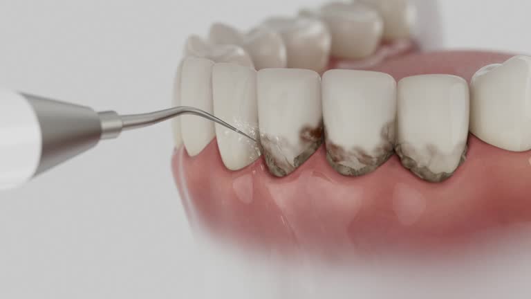 Reliable Dental Implants contractor in Clarksburg, MD by Smile Center Dentistry